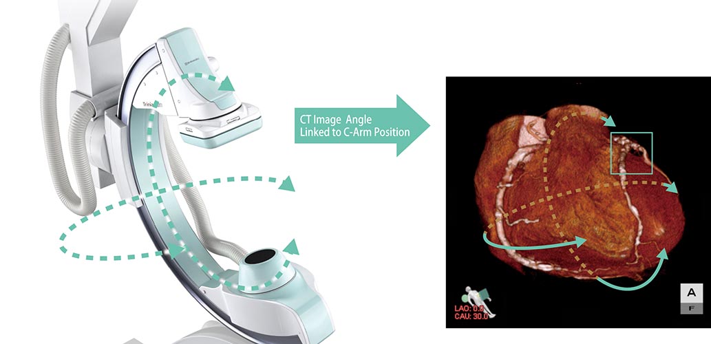 angiograf digital trinias mix package shimadzu imagini clinice